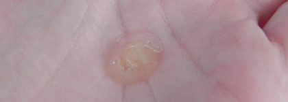 Сыворотка для лица It's Skin It’s skin Power 10 Formula LI Effector и гиалуроновый стартер Holika Holika 3 Seconds Starter Hyaluronic Acid