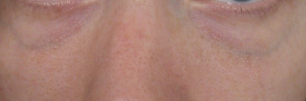 Почти любовь с консилером Clarins instant concealer 01 yellowy-beige