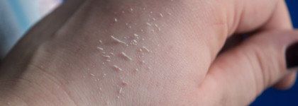 Самый эффективный пилинг-скатка в моей коллекции