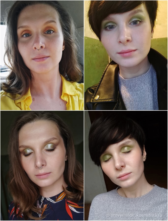 Филлеры для лица до и после фото