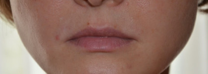 Укрощение строптивой кожи с помощью Calendula Herbal Extract Alcohol-Free Toner от Kiehl's