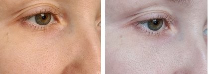 Греческий йогурт с пробиотиками для Вашей кожи с маской Korres "Hydra-Biome Greek Yoghurt Probiotic Superdose Face Mask"