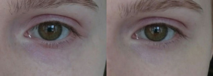 Корректор для области вокруг глаз Shiseido Sheer Eye Zone Corrector #101