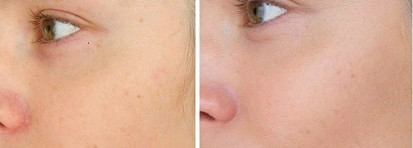 Chanel Vitalumiere Aqua Ultra Light Skin Perfecting Makeup SPF 15 оттенок 32 Beige rose