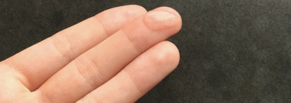 Cosrx - спасение для проблемной кожи?