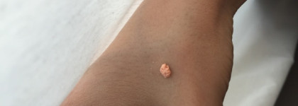 Очередное помешательство на Clinique. Часть 2. Clinique Superprimer Colour Corrects Discolorations