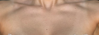 La Roche-Posay Anthelios Dermo-Pediatrics Invisible Spray Spf50+ детский солнцезащитный невидимый спрей для лица и тела