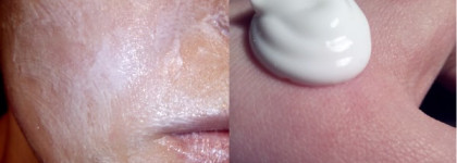 Достойные помощники для ухода за кожей лица Avene Cleanance Mask & Avene Masque apaisant hydratant