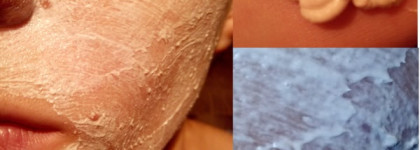 Достойные помощники для ухода за кожей лица Avene Cleanance Mask & Avene Masque apaisant hydratant