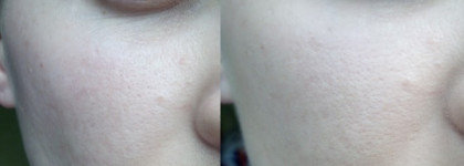 Vichy Normaderm Teint Anti-imperfection Foundation – Тональный крем для проблемной кожи