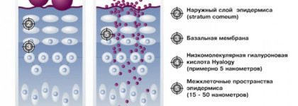 Низкомолекулярная гиалуроновая кислота ONmacabim L.r.n. Solution 3,2 % и мезороллер MT Microneedle Therapy system