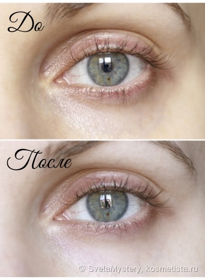 Мой уход за кожей от Skin Doctors: Beetox Actively Defies Agening и YouthCell Youth Activating Eye Cream