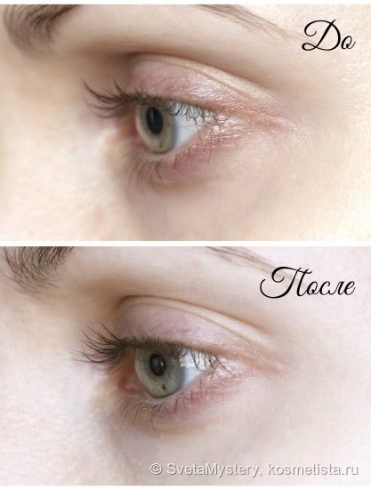Мой уход за кожей от Skin Doctors: Beetox Actively Defies Agening и YouthCell Youth Activating Eye Cream