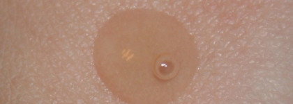 Улитки нам помогут... Сыворотка Limoni Snail Repair Intensive Ampoule