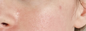 Тональный крем из аптеки Liftactiv Flexilift в оттенке 15 Opal от Vichy