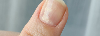 Настоящее золото - укрепляющий лак для ногтей White Gold Care от Berenice