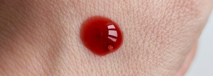 Кровавый пилинг для лица Deep Peeling AHA 10% + BHA 2% + Red Algae от Biobalance