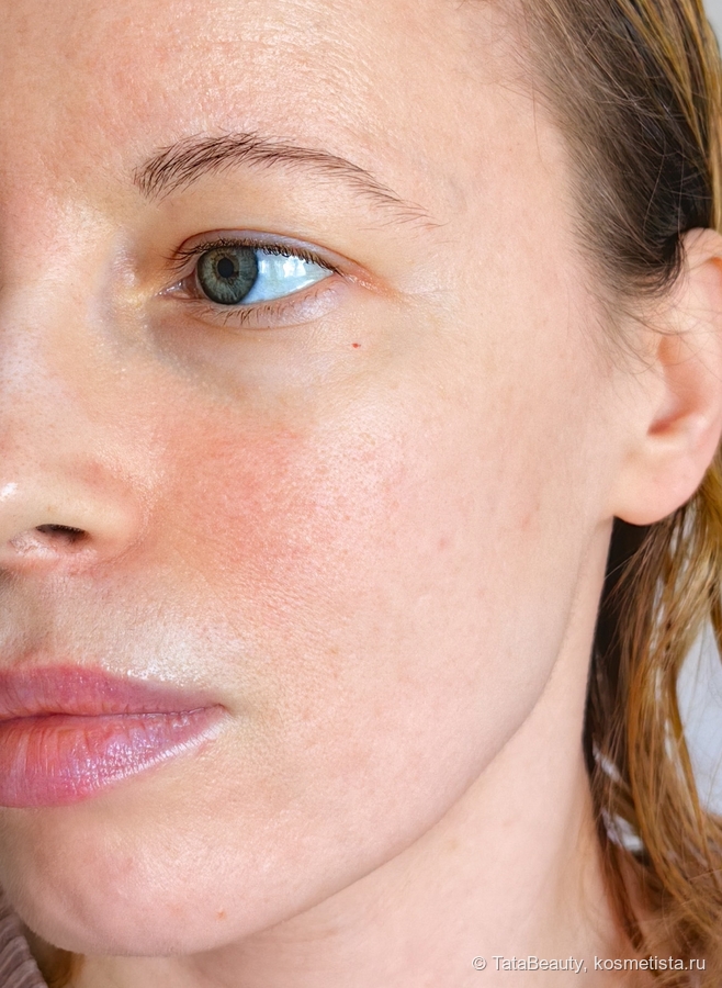 Лицо только с увлажняющим кремом