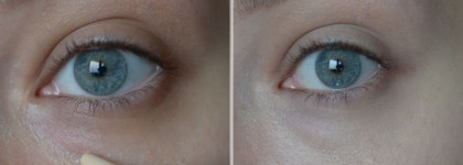 Поиски идеального консилера для очень темных кругов под глазами