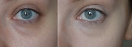 Поиски идеального консилера для очень темных кругов под глазами