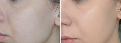 Dr.Jart+ Beauty Balm Radiance Capsules Natural Coverage