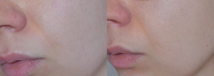 Пептидная очищающая глиняная маска для жирной кожи GIGI Nutri Peptide Clay Mask