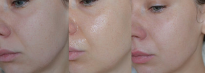 Лимфодренажная гелевая маска Face Sculpt Anti-Puff Mask Icon Skin