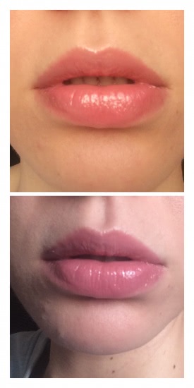 Итальянская красотка Kiko ultra glossy stylo № 803 Pink Flamingo