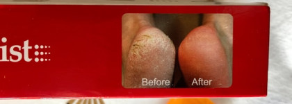 И Ваши пяточки как у младенца: Callus peel Mist 3 in one Kit