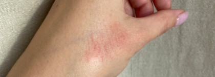 Доставщика ретинола заказывали? Липосомальная сыворотка с ретинолом 1% Анна Шарова