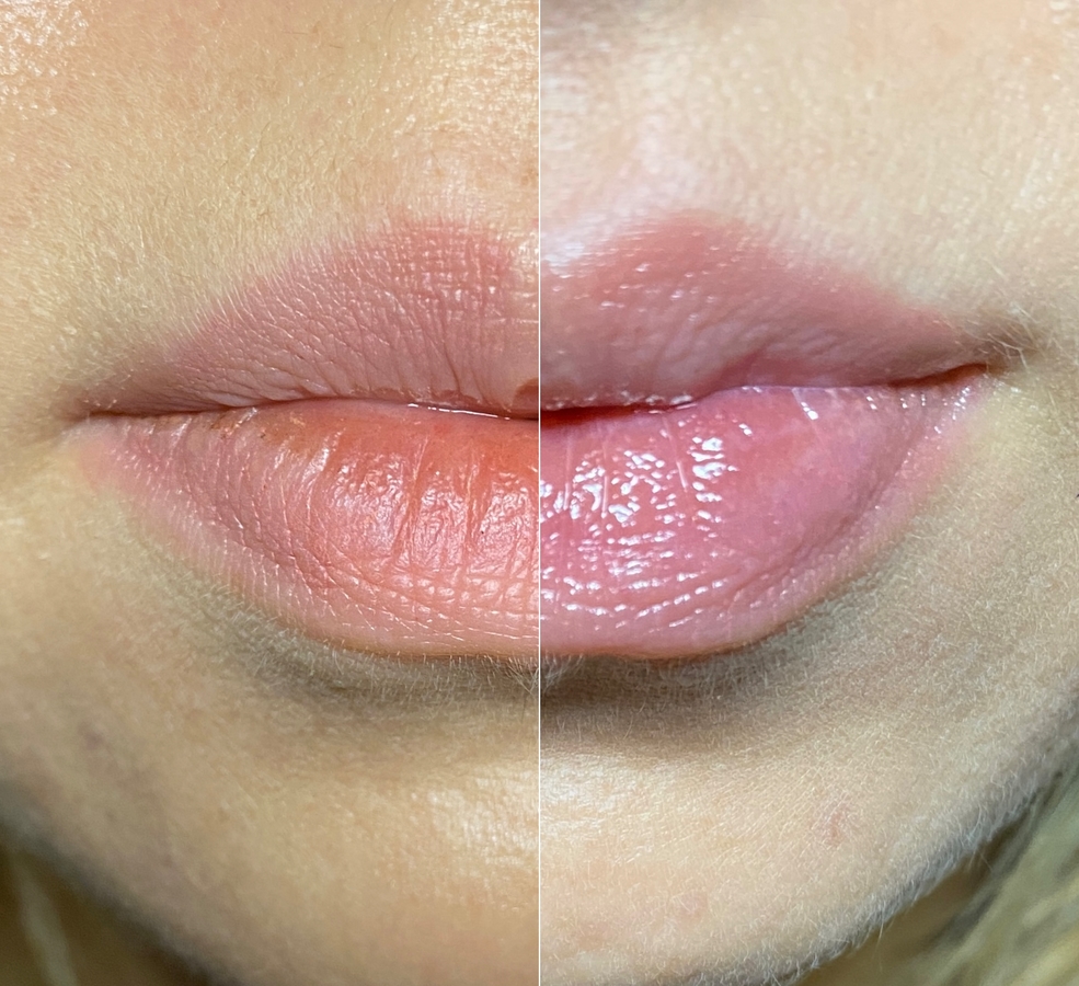 Слева "голые губы", справа с бальзамом. Освещение было одинаковое, но фото почему-то проучились разные