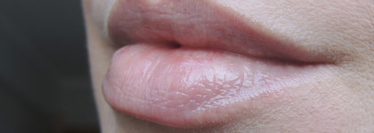 Спасаем губы зимой