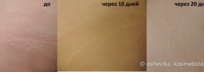 Lierac Phytostil в борьбе с растяжками