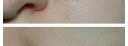 Мой первый СС продукт - Lumene Color Correcting Powder 6 in 1 оттенок Medium/deep. Знакомство оказалось неудачным