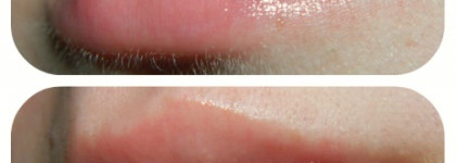 Мои губы всегда сияющие и увлажненные. А все почему? Потому что у меня есть Бальзам для интенсивного ухода за губами Almea Xlips Efg