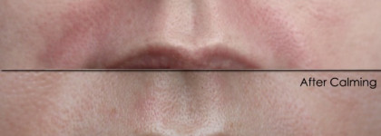 Для тех, кто эпилирует и выщипывает: крем Klairs Midnight Blue Calming Cream