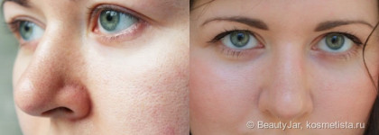 Упорная работа и немного волшебства: сыворотки для сужения пор The Skin House Tightening Plus и White Tightening. С фото до-после-после