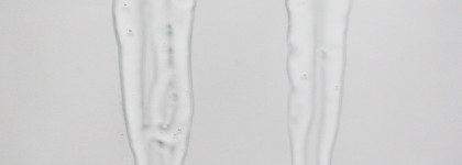 Упорная работа и немного волшебства: сыворотки для сужения пор The Skin House Tightening Plus и White Tightening. С фото до-после-после