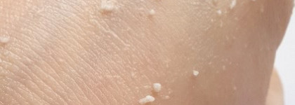 Приручение пилинга скатки Nature Republic Super Aqua Max Soft Peeling Gel