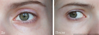 Любимый консилер от Guerlain Precious Light Rejuvenating Illuminator в оттенке #00