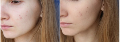 Мой фаворит тонального средства на теплое временя года CC крем «Абсолютное совершенство» Lumene CC Color Correcting Cream With Arctic Lingonberry 6 in 1 SPF 20. Оттенок Medium