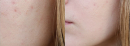 Я нашла свой Photoshop:  L'Oreal Infallible "24ч Матовое Покрытие" - Стойкий Матирующий Тональный Крем в оттенке #12 "Розовая ваниль"