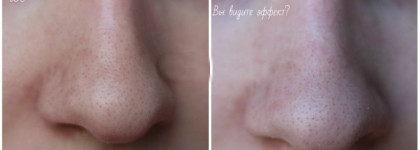 Вы видите результат? Я не вижу. Подробный обзор на корейское средство против черных точек Lioele Blackhead Clear