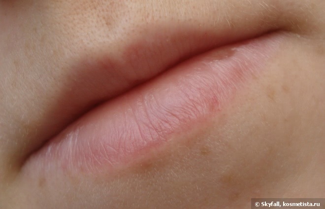 Бальзам для губ Almea Xlips plumper: увеличиваем губы в домашних условиях