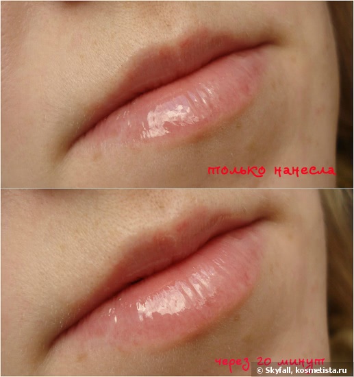 Бальзам для губ Almea Xlips plumper: увеличиваем губы в домашних условиях