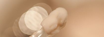 Подтянутый тургор от Shiseido. Это ли не чудо?