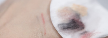 Мицеллярная вода Effaclar Ultra La Roche-Posay