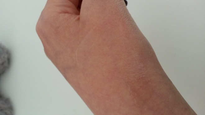 Filorga skin structure и неожиданный успех в борьбе с носогубными складками