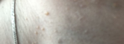 Когда результат говорит сам за себя: Nip+Fab Glycolic Fix Gentle Pads (фото до и после)