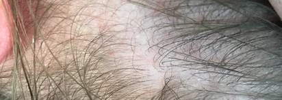 Как я спасала волосы после комы